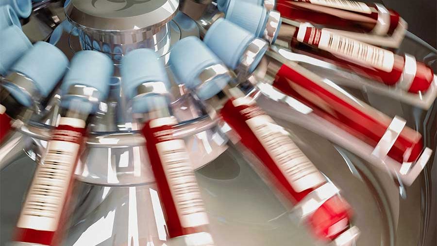 Blood vials spinning