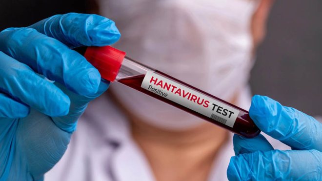 Hantavirus outbreak test